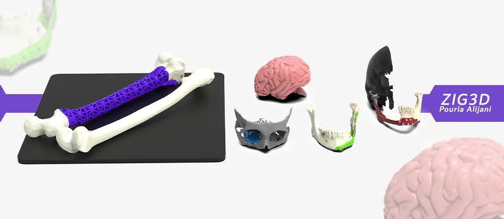 MEDICAL ZIG3D