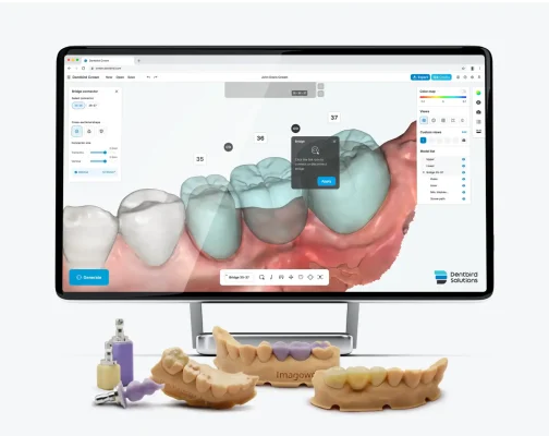 Zig3d&dentalbird-ai design crown Zig3d&dentalbird-ai design crown